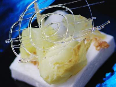 Auberge des Glazicks